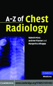 A-Z of Chest Radiology
