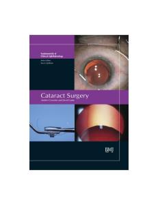 Cataract Surgery: FCO Series