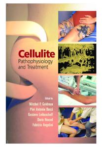 Cellulite Pathophysiology and Treatment