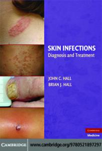 Skin Infections: Diagnosis and Treatment