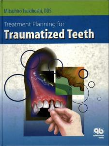 Treatment Planning for Traumatized Teeth