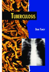 Tuberculosis (Twenty-First Century Medical Library)