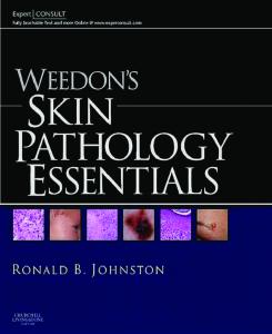 Weedon's Skin Pathology Essentials: Expert Consult: Online and Print